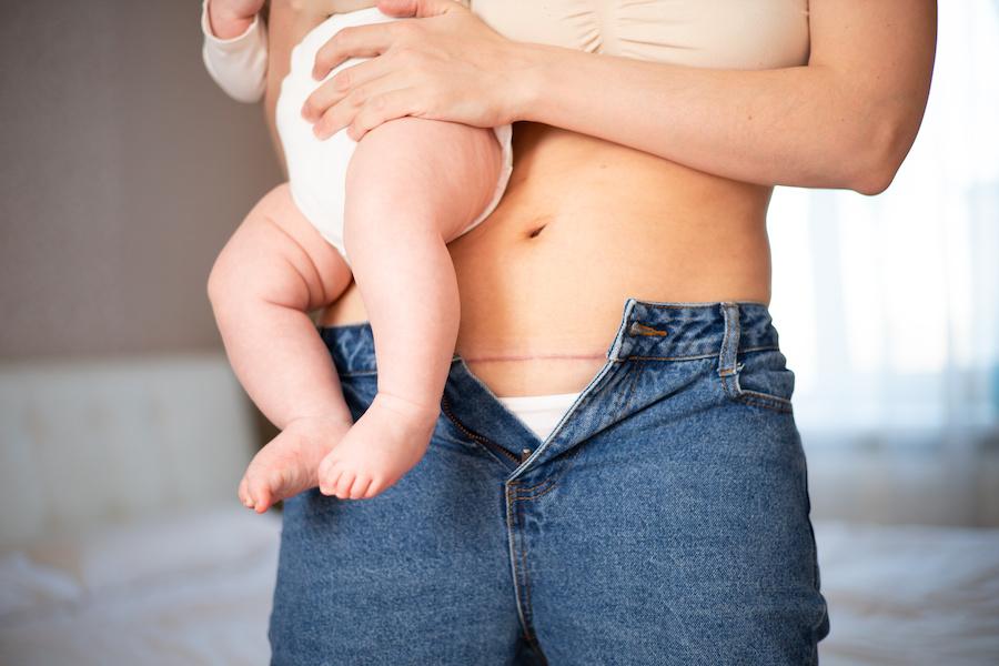 AdobeStock 504405383